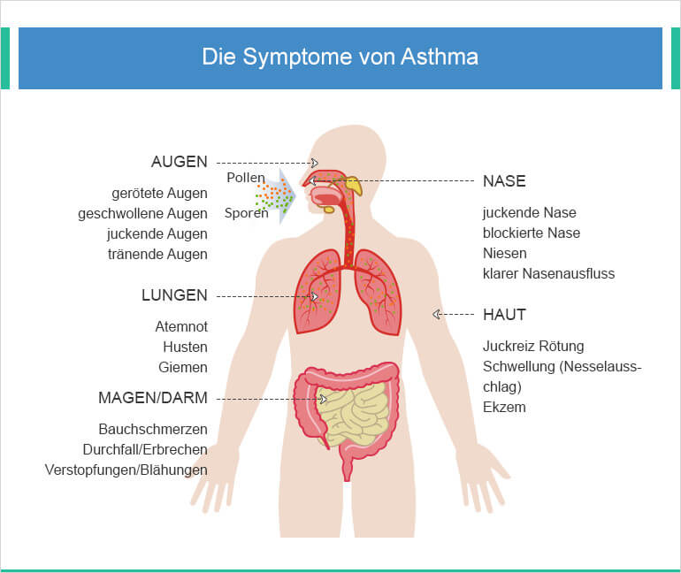 Anzeichen von Asthma